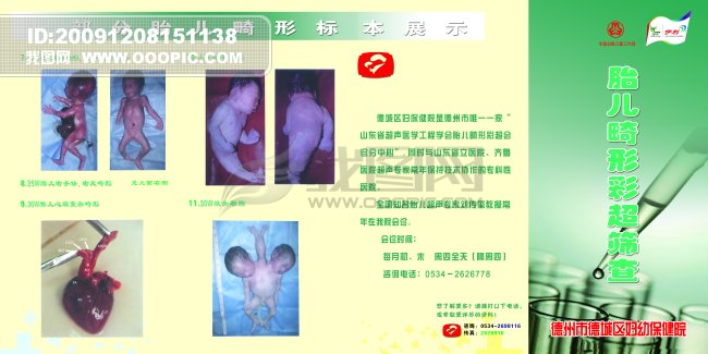 胎儿畸形彩超筛查模板下载(图片编号:785196)